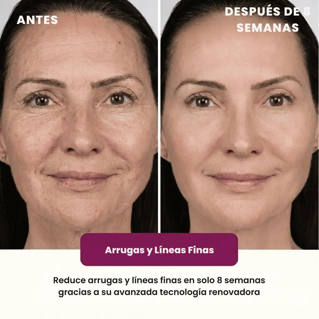 Dermavia® Crepe Fix Avanzado